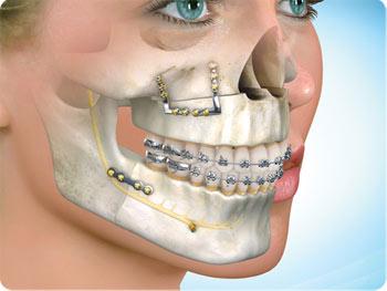 Oral and Maxillofacial Surgeon in bangalore