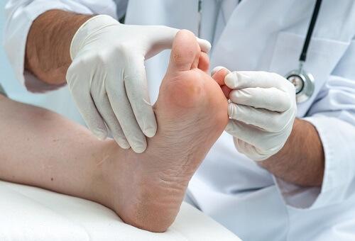 Diabetic Foot Deformity Correction